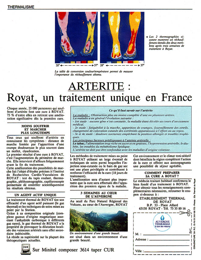 BrandZxDiversCures 1987